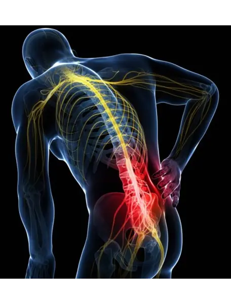Fysiotherapie bij acute rugpijn